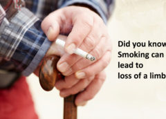SVS – Three reasons why smokers are at higher risk of amputations