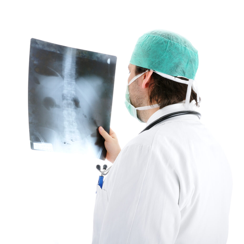 non-small cell lung cancer