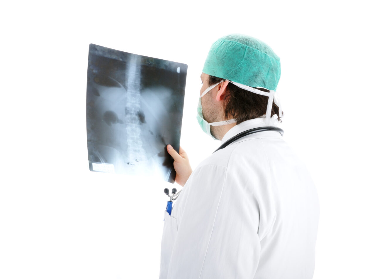 non-small cell lung cancer